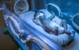 What Is Jaundice in Newborns and How Is It Treated?